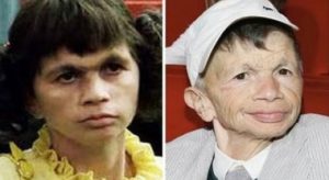 Scopri di più sull'articolo Plinio Fernando oggi: la vita dell’attore che interpretava Mariangela in Fantozzi